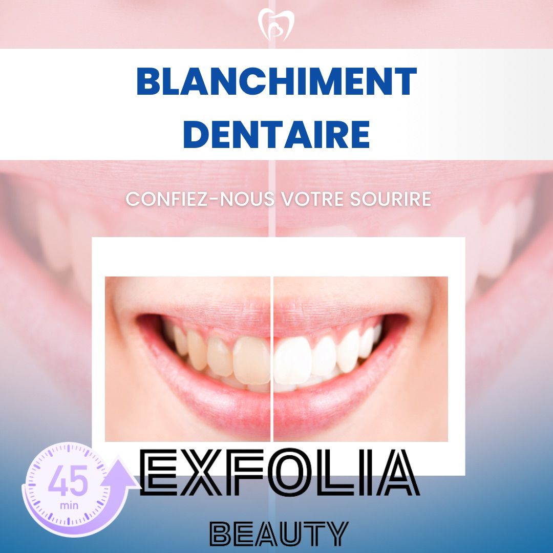 Blanchiment dentaire